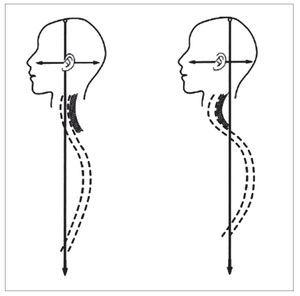 postura mandibula - Clinica Integrativa Barcelona